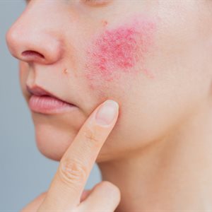 New Dermatology short course for healthcare professionals