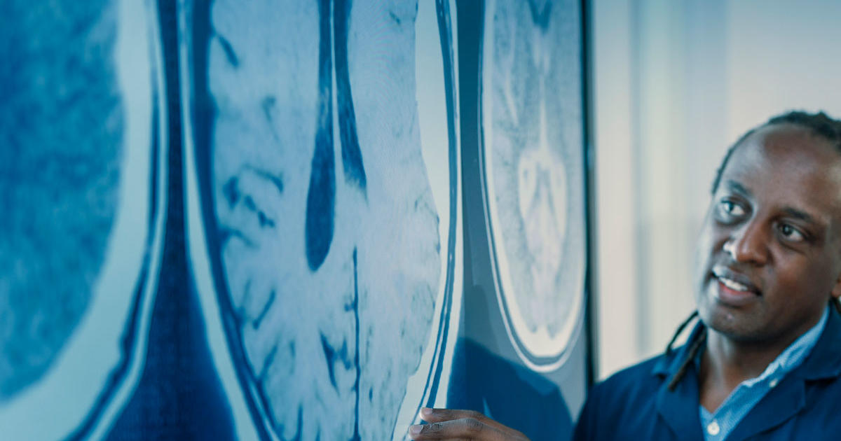 MSc in Clinical Anatomy Hull York Medical School