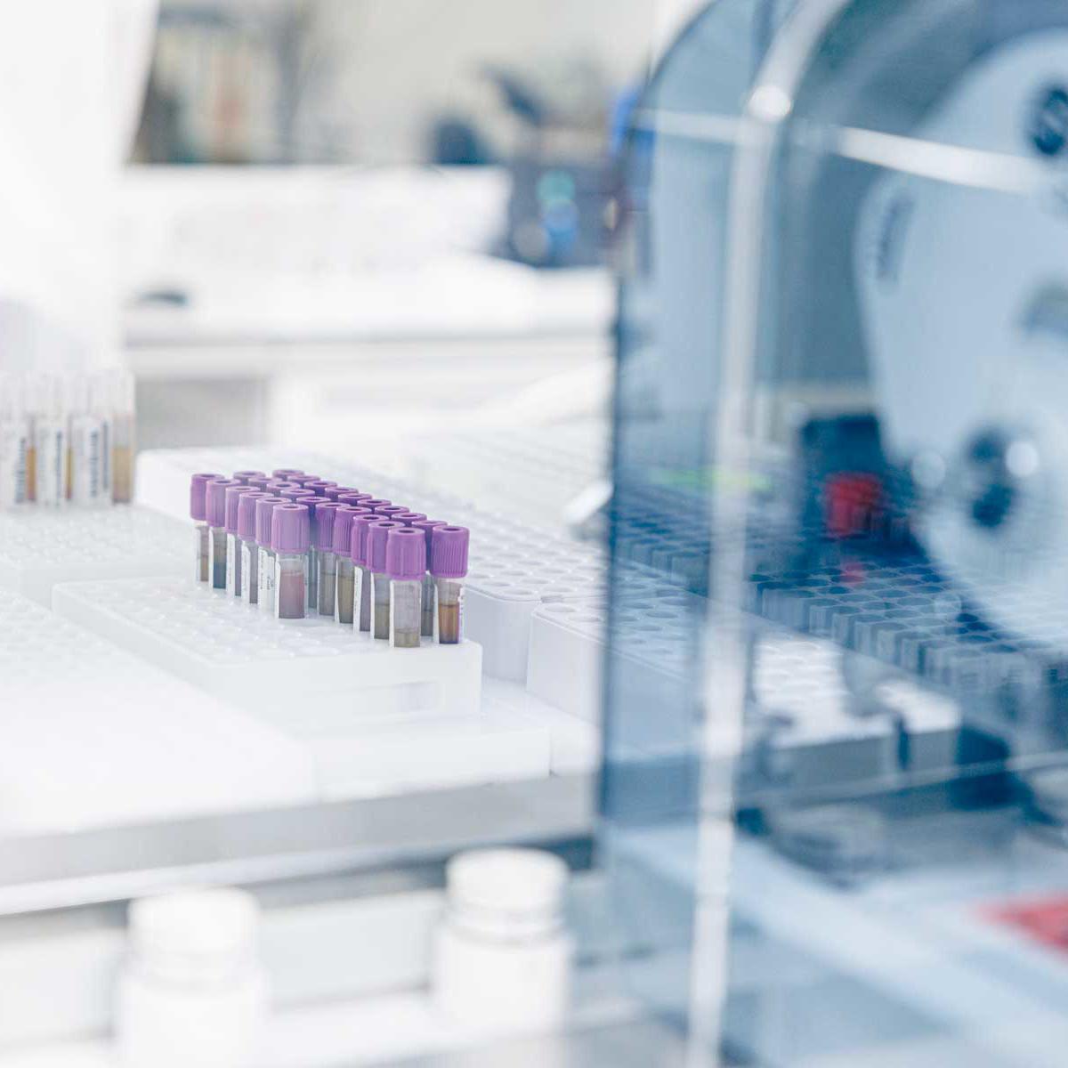 Blood samples in NHS cancer testing facilities